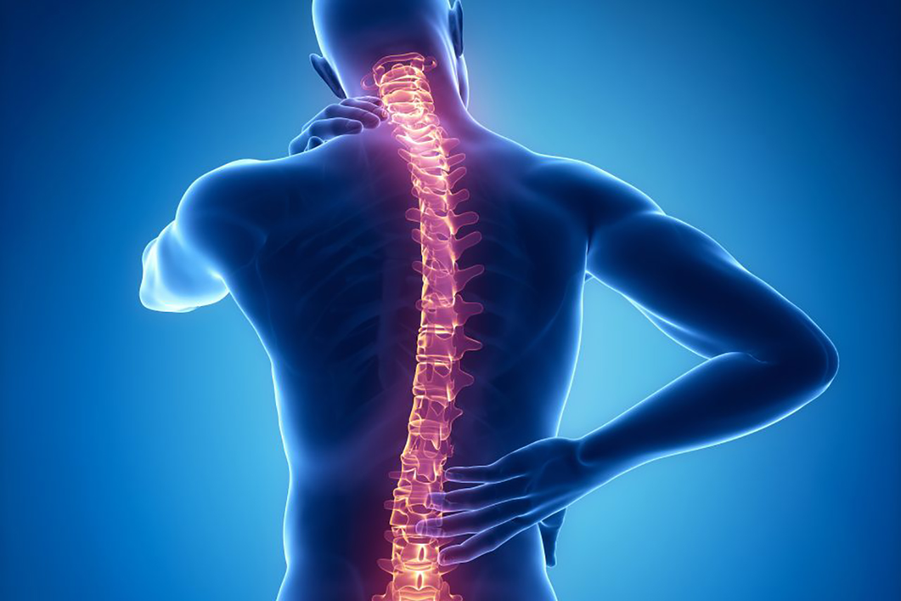 ویدیو عمل جراحی اسکولیوز