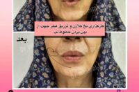 پزشک پوست ومووزیبایی درمحدوده شریعتی وپیروزی