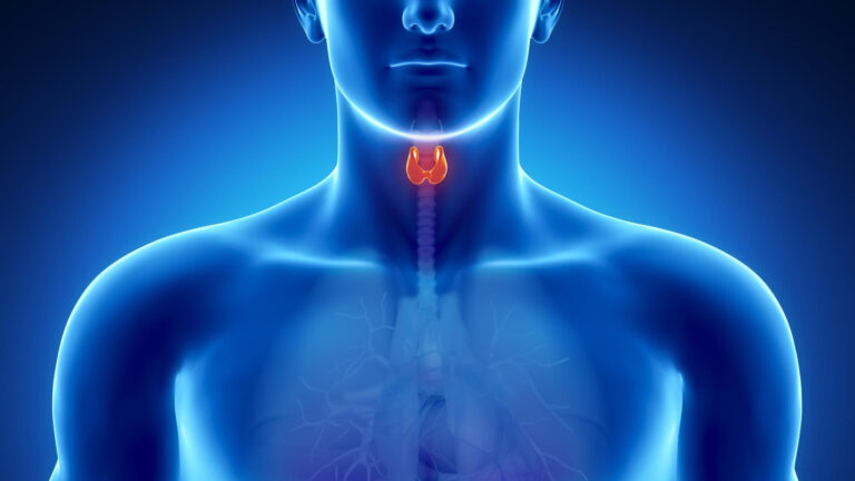 پرکاری تیروئید - Hyperthyroidism