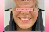 پزشک پوست ومووزیبایی درمحدوده شریعتی وپیروزی