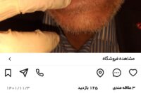 لابراتوار دندانسازی شهرک غرب سعادت آباد فرحزاد
