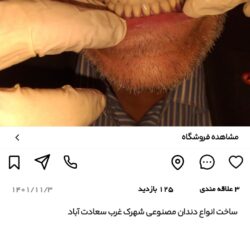 لابراتوار دندانسازی شهرک غرب سعادت آباد فرحزاد