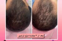 پزشک پوست ومووزیبایی درمحدوده شریعتی وپیروزی