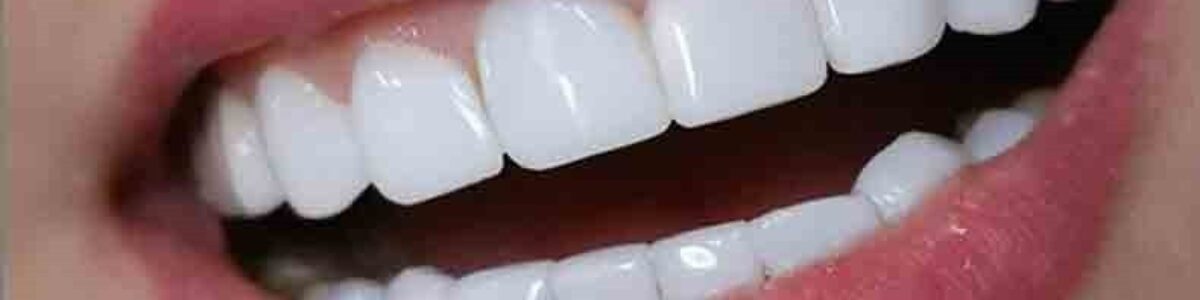 مطب دندانپزشکی دکتر زهرا باقری