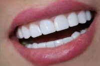 مطب دندانپزشکی دکتر زهرا باقری
