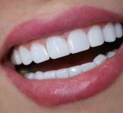 مطب دندانپزشکی دکتر زهرا باقری