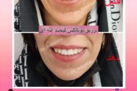 پزشک پوست ومووزیبایی درمحدوده شریعتی وپیروزی