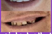 مطب دندانپزشکی دکتر زهرا باقری