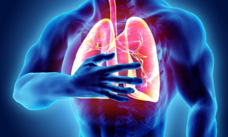 فیبروز ریه - Pulmonary fibrosis