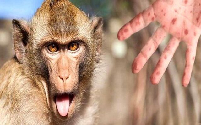 ژنتیک غیر متعارف در ویروس آبله میمون شناسایی شد