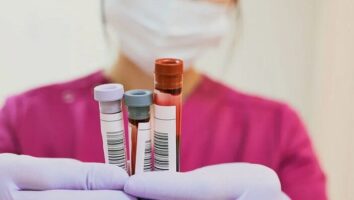 آزمایش CBC چیست و چه بیماری‌هایی را نشان می‌دهد؟