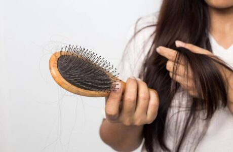 کدام نوع ریزش مو طبیعی است؟