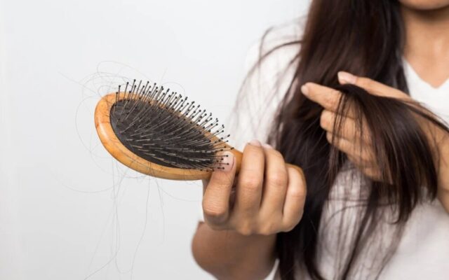 کدام نوع ریزش مو طبیعی است؟