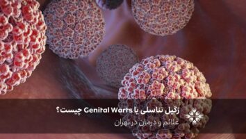 زگیل تناسلی یا Genital Warts چیست؟ علائم و درمان در تهران