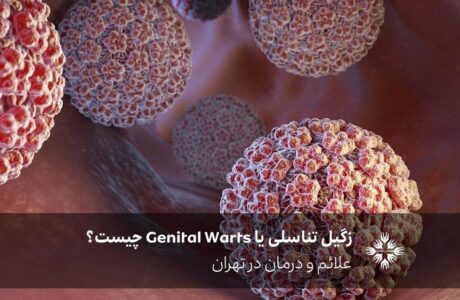 زگیل تناسلی یا Genital Warts چیست؟ علائم و درمان در تهران