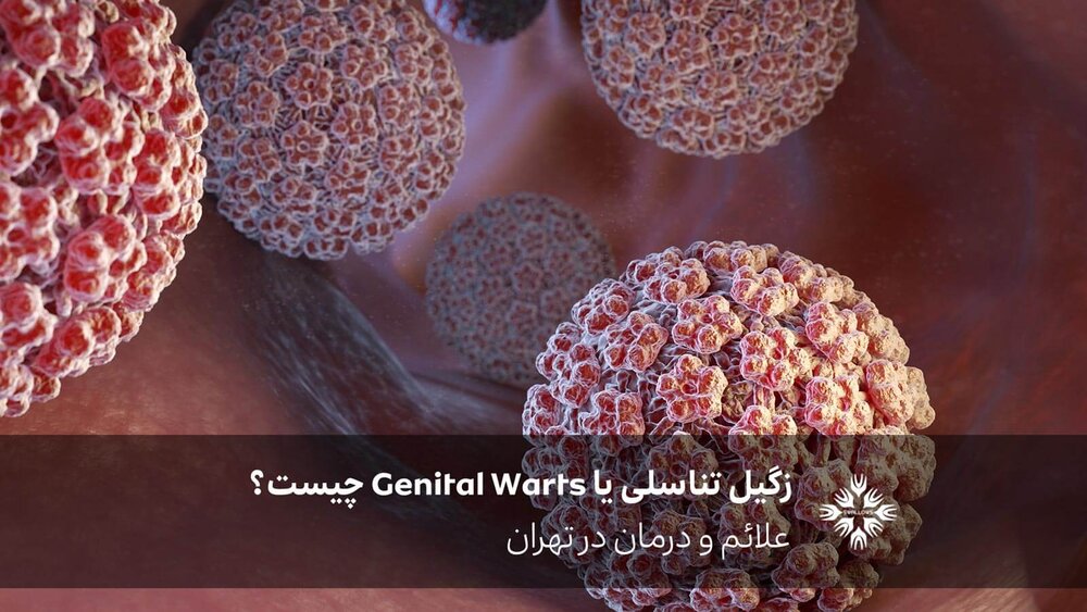 زگیل تناسلی یا Genital Warts چیست؟ علائم و درمان در تهران