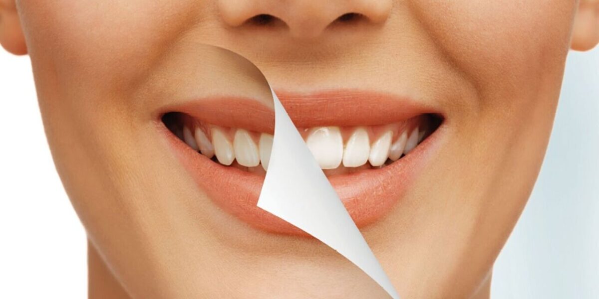 ۶ ترفند سفید کردن دندان‌ها