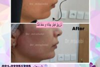 پزشک پوست ومووزیبایی درمحدوده شریعتی وپیروزی