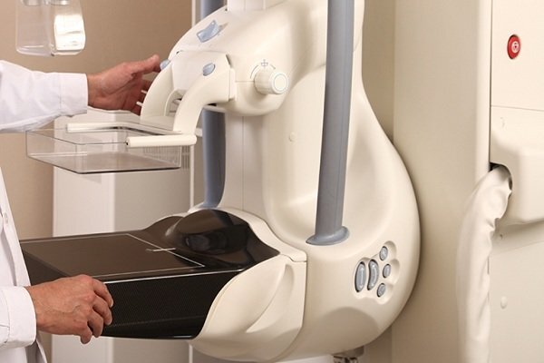 زنان از چند سالگی ماموگرافی انجام دهند/ علائم کیست پستان