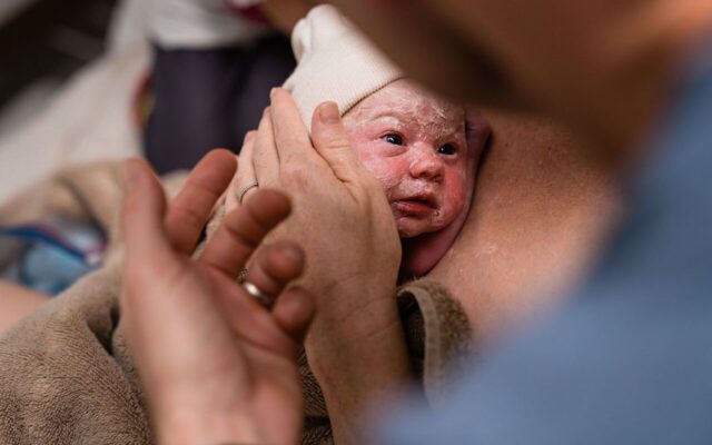 تاثیر مثبت تماس پوست به پوست نوزاد و مادر بلافاصله بعد از سزارین