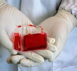 سالانه ۵۰ هزار پیوند سلول‌های بنیادی خونساز در جهان انجام می‌شود