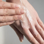 چگونه از خشکی شدید پوست در سرما جلوگیری کنیم؟
