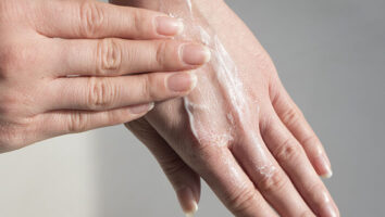 چگونه از خشکی شدید پوست در سرما جلوگیری کنیم؟