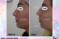 پزشک پوست ومووزیبایی درمحدوده شریعتی وپیروزی
