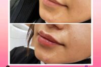پزشک پوست ومووزیبایی درمحدوده شریعتی وپیروزی