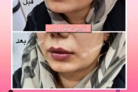 پزشک پوست ومووزیبایی درمحدوده شریعتی وپیروزی
