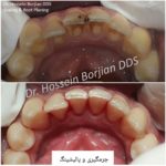 دکتر حسین برجیان بروجنی – دندانپزشک