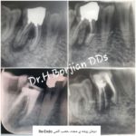 دکتر حسین برجیان بروجنی – دندانپزشک