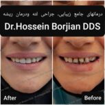 دکتر حسین برجیان بروجنی – دندانپزشک – ایمپلنت