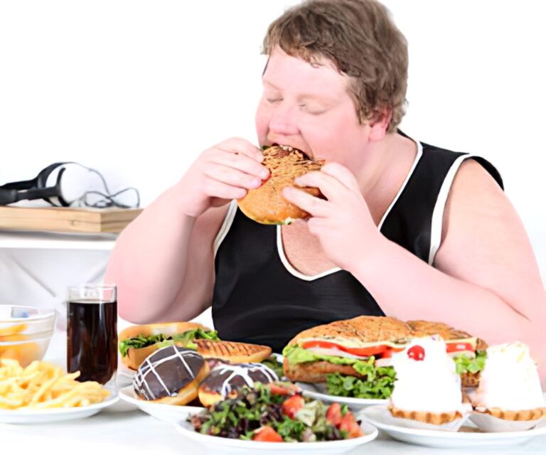اختلالات مرتبط با غذا خوردن - Food Disorders