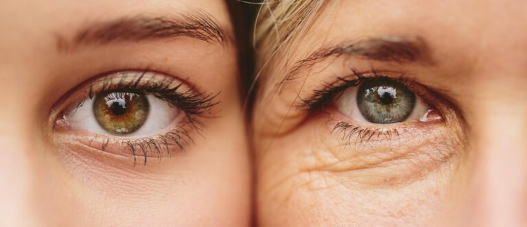 پیرچشمی - Presbyopia