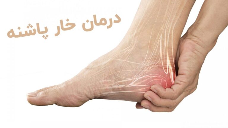 خار استخوانی - Bone spurs - osteophyte