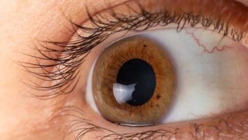 ۵ گام برای پیشگیری از بیماری چشمی ناشی از دیابت