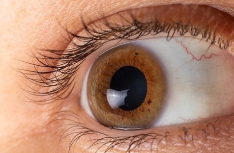 ۵ گام برای پیشگیری از بیماری چشمی ناشی از دیابت