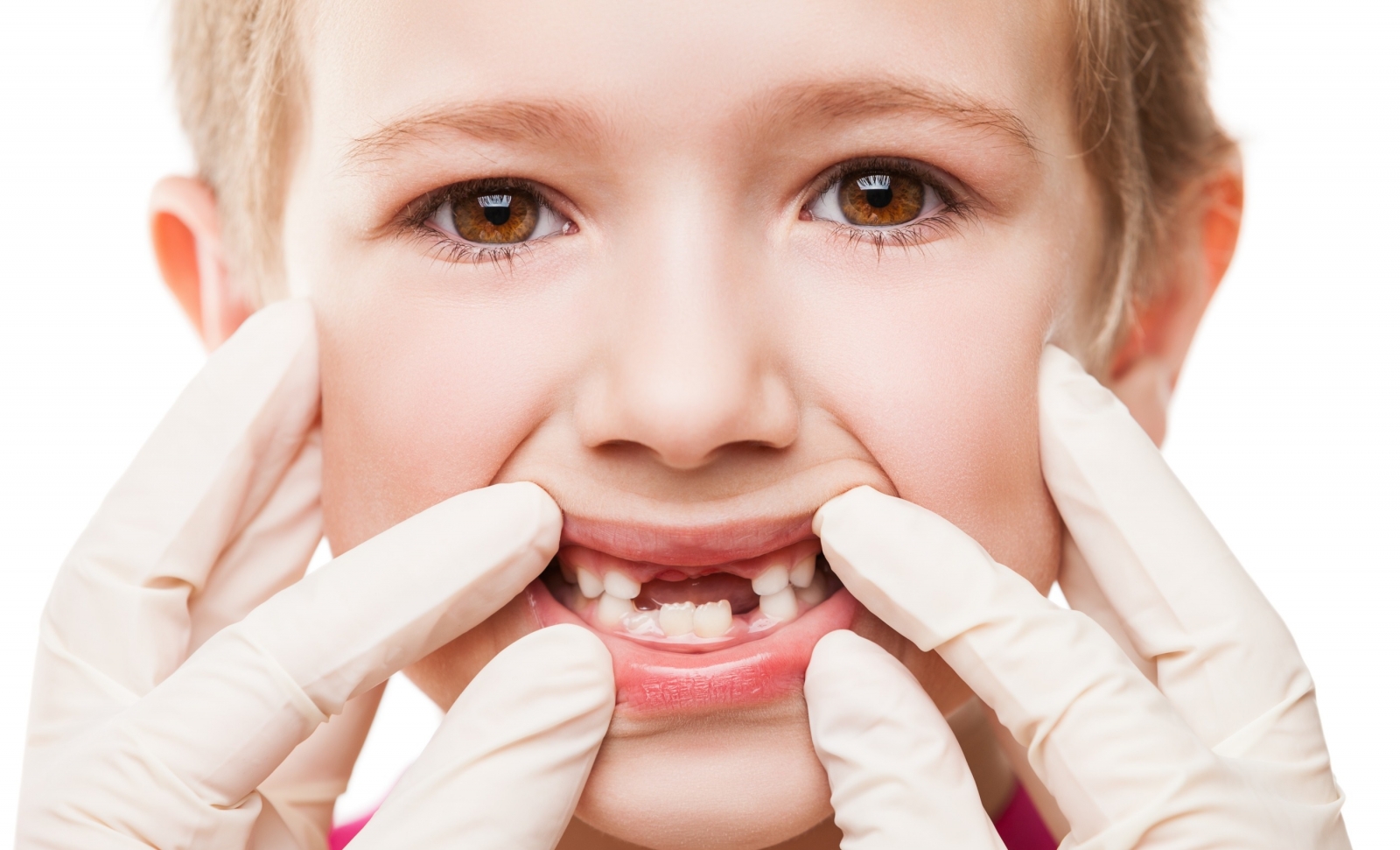 دندان شیری چه زمانی در می آید و می‌افتد؟