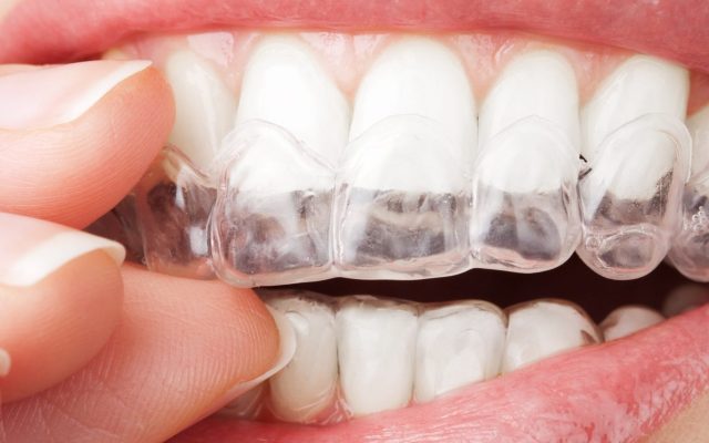 آشنایی با فرایند و محصولات دندان پزشکی