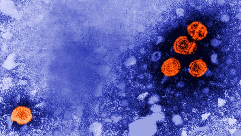 هپاتیت - Hepatitis