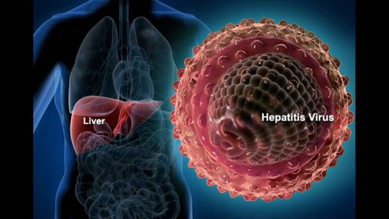 هپاتیت دی - Hepatitis D