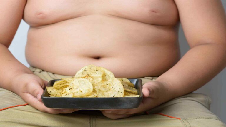 چاقی کودکان - Childhood obesity